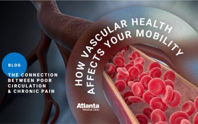 The Connection Between Poor Circulation and Chronic Pain