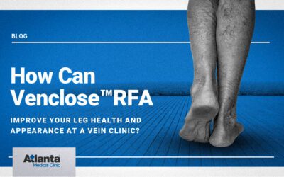 How Can VENCLOSE™ RFA Improve Your Leg Health